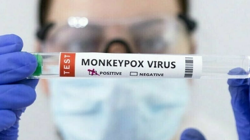 WHO proposes renaming monkeypox